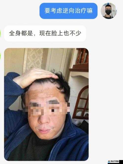 四叔索取盛年岂：困扰与无奈